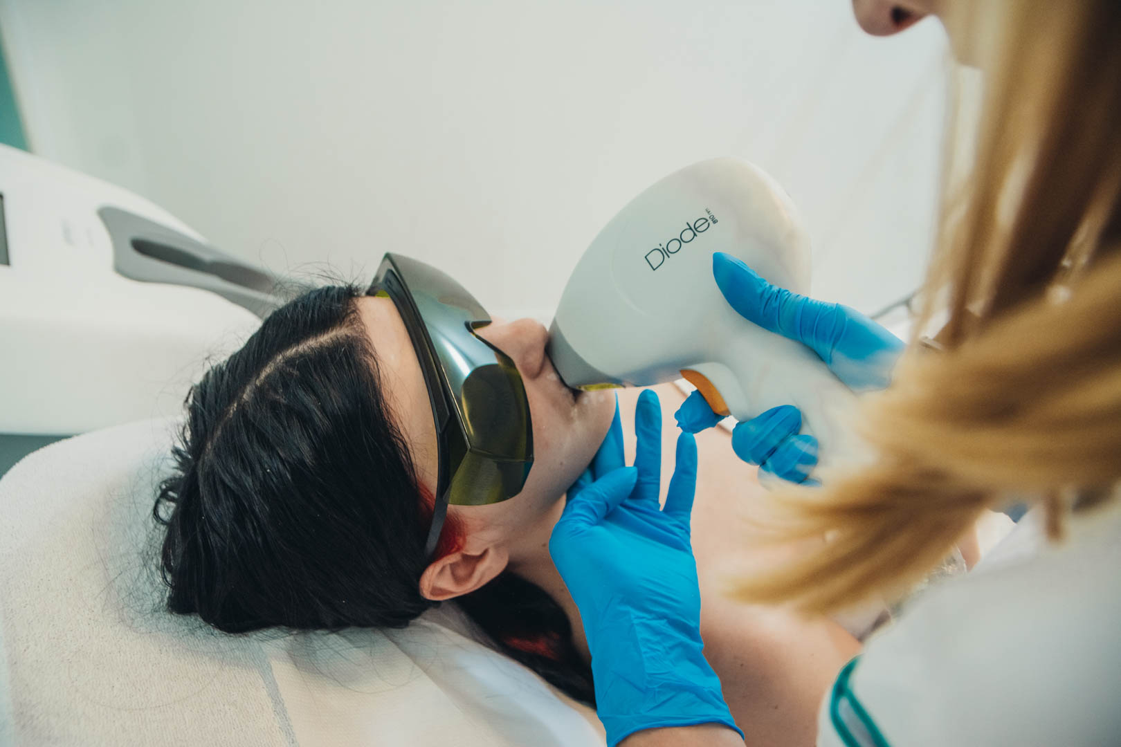 Epilarea definitiva cu laser solutia pentru tratarea hirsutismului si hipertricozei la Episculpt Beauty Sibiu