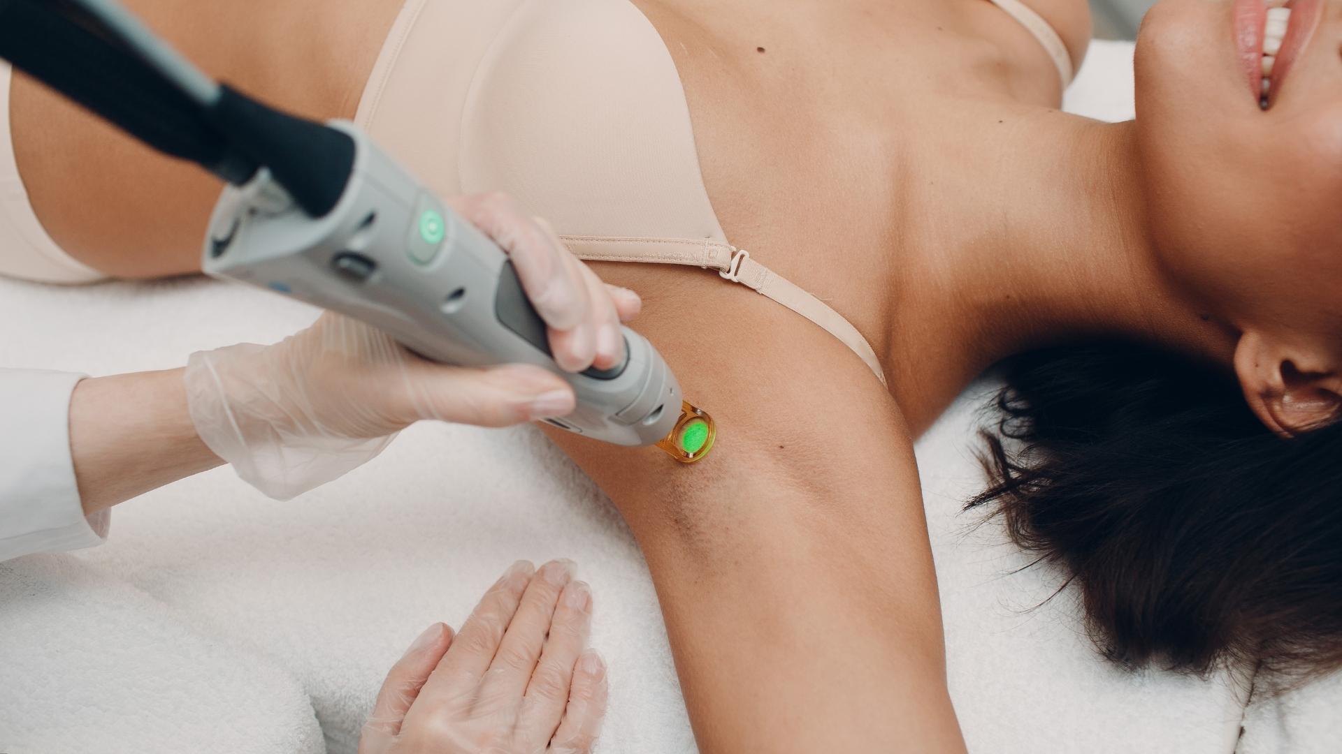 epilare definitiva axile cu laser alexandrite la episculpt beauty sibiu