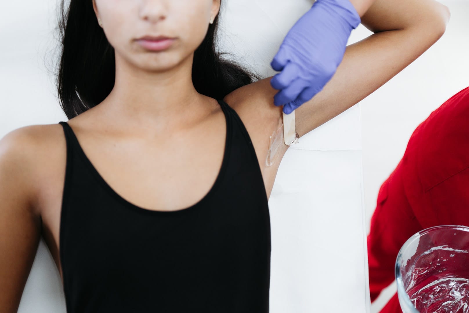 Aplicarea gelului pentru procedura de epilare definitiva la axile la Episculpt Beauty Sibiu