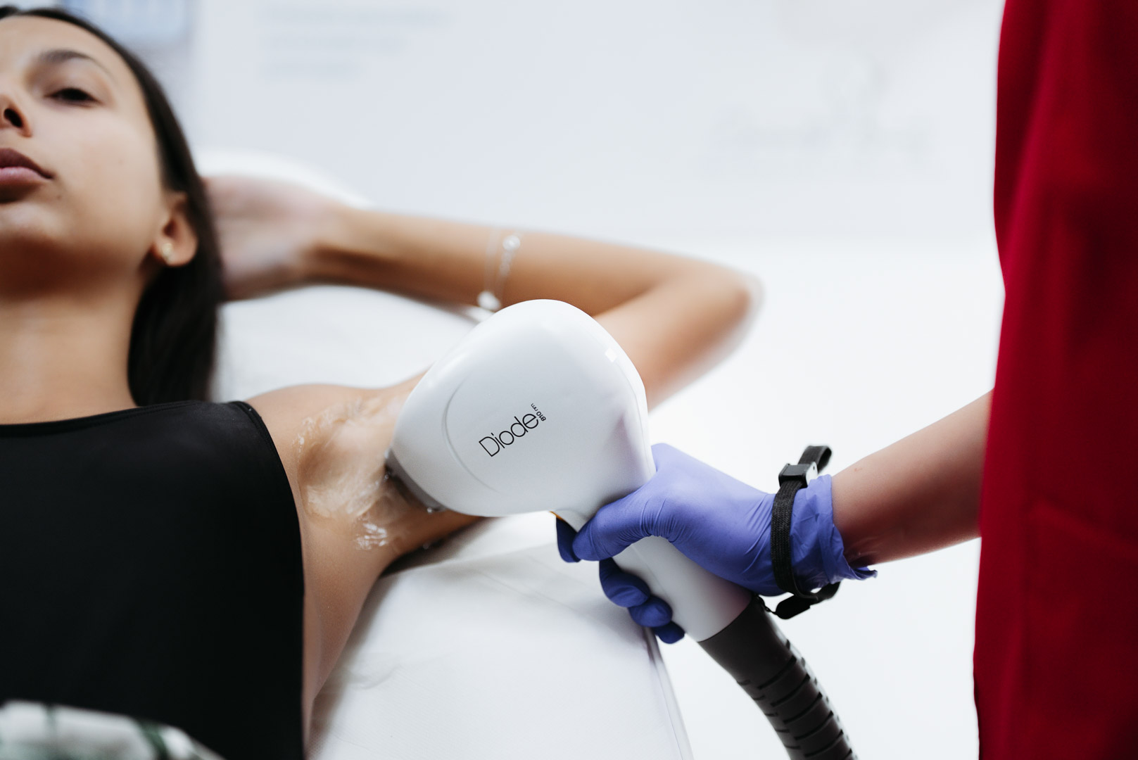 Tratament de epilare definitiva la axile cu laser dioda Primelase HR Excellence la Episculpt Beauty Sibiu