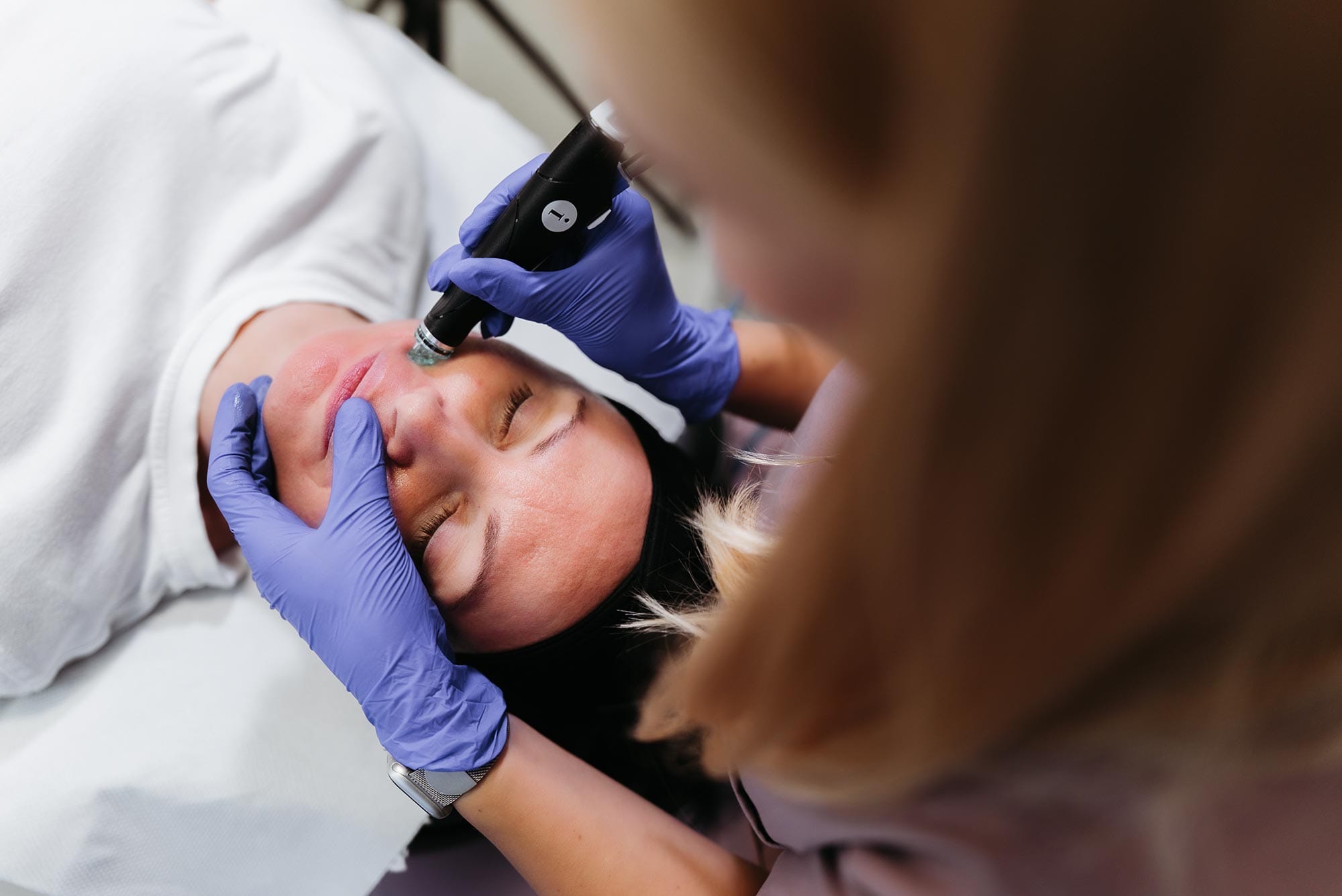 Centru de epilare definitiva si estetica in Sibiu – Episculpt Beauty