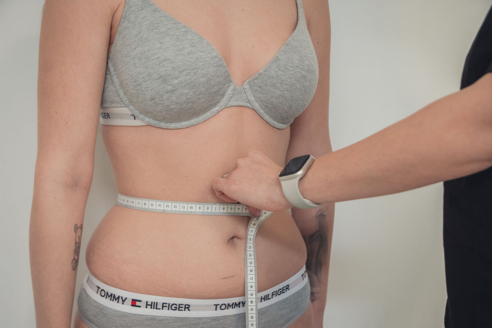 masurare si stabilirea zonelor pe care se vor aplica proceduri de remodelare corporala