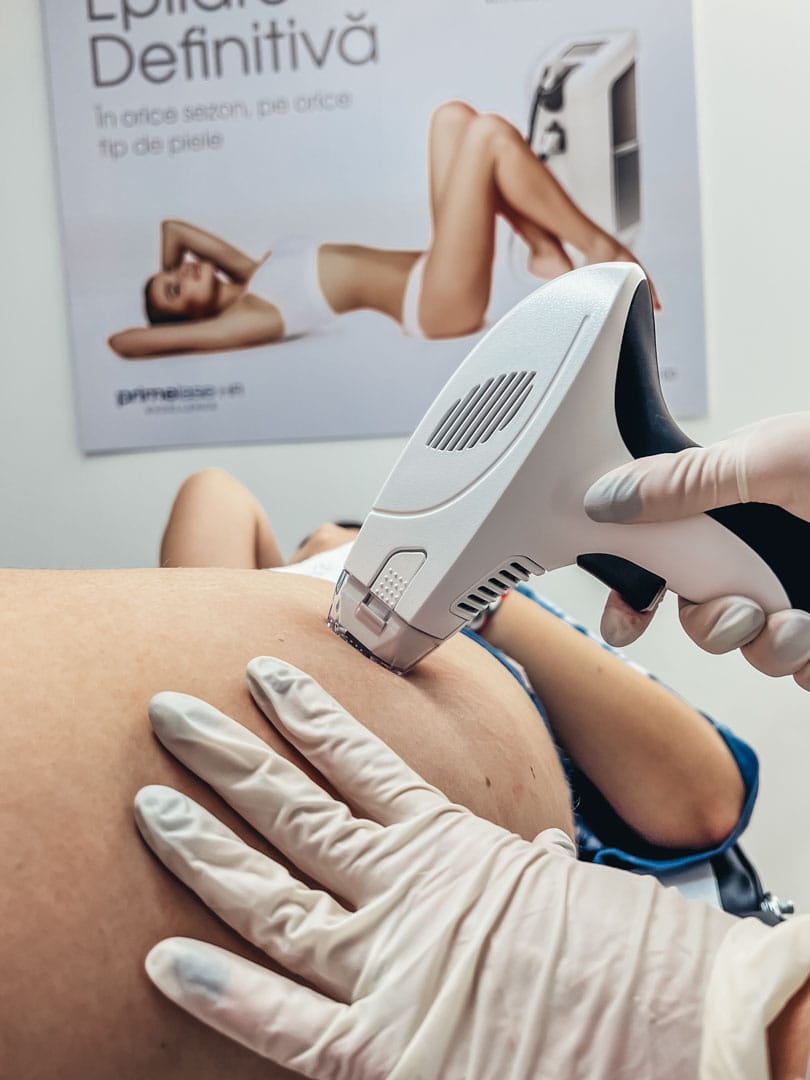 procedura de rejuvenare a pielii in zona coapselor