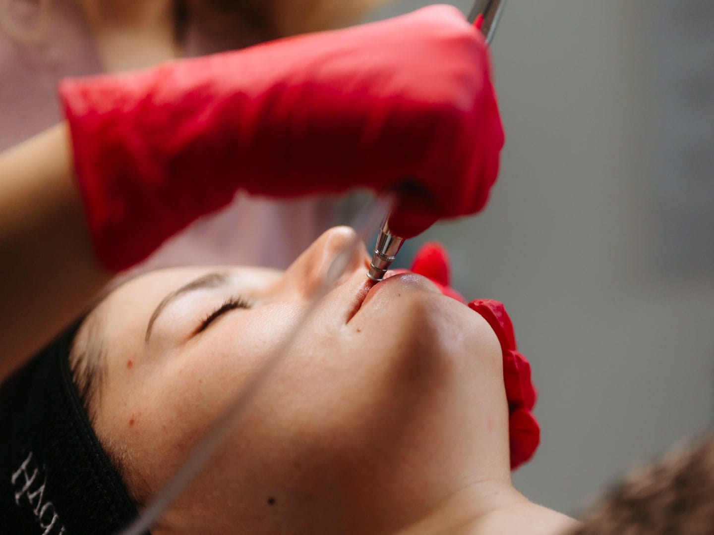 tratament de rejuvenare a pielii Intraceuticals Sibiu la Episculpt Beauty