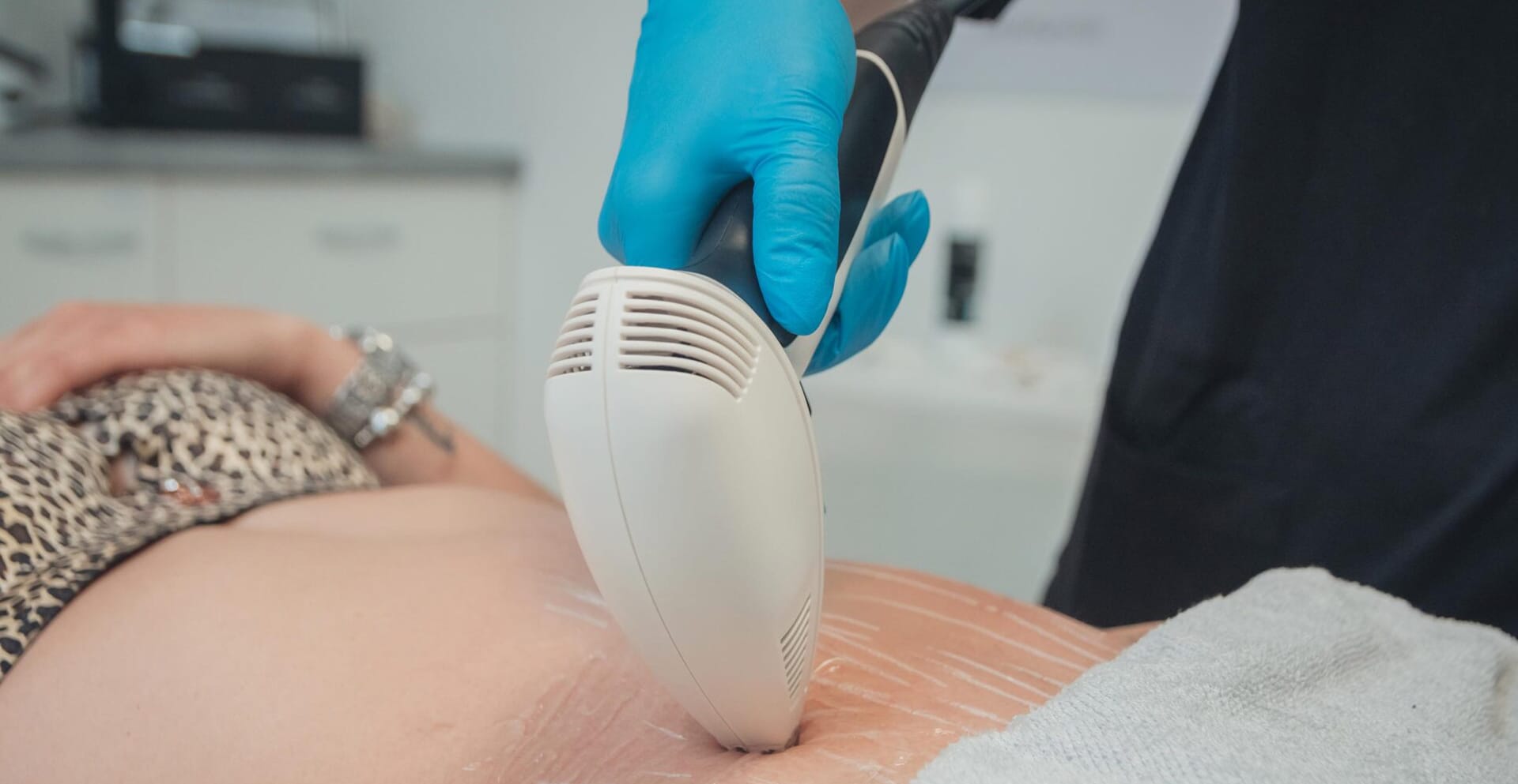 Tratament estetic pentru piele, reducerea vergeturilor prin radiofrecventa bipolara