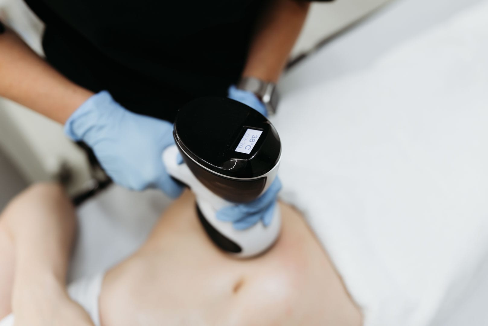 aplicare tratament de radiofrecventa corporala in zona abdomenului pentru reducerea tesutului adipos