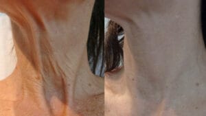 rezultat rejuvenare gat prin radiofrecventa fractionata cu viora v10 v-fr