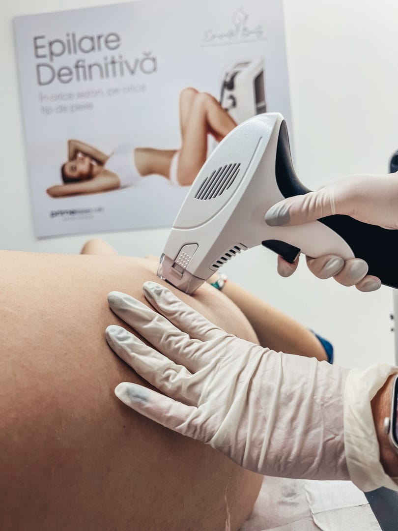 tratament estetic prin radiofrecventa fractionata